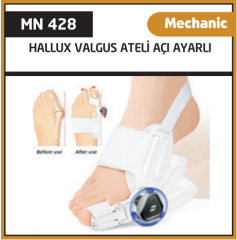 Minion Açı Ayarlı Mekanik Halluks Valgus Ateli